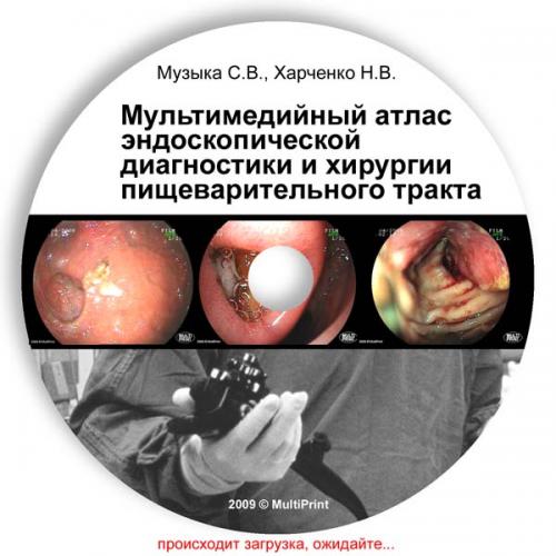 эндоскопическая диагностика и хирургия пищеварительного тракта (мультимедийное издание - 2009)